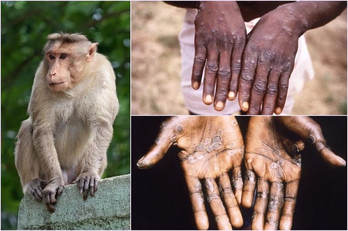 Bệnh đậu mùa khỉ: Hãy xem hình ảnh đáng yêu của các con khỉ để hiểu rõ hơn về bệnh đậu mùa khỉ và cách phòng tránh. Chúng ta không thể ngừng được yêu thương các con vật đáng yêu này.