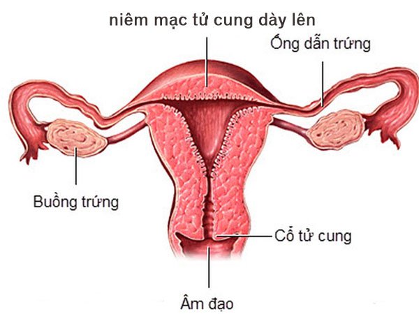 Niêm mạc tử cung bao nhiêu là bình thường?